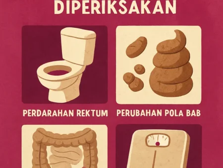 Tanda-Tanda Kanker Usus Besar yang Harus Segera Diperiksakan